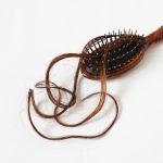 Female hair loss consultations are rising globally, driving new approaches in hair restoration medicine and personalised treatment.
