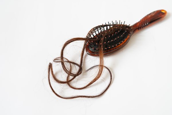 Female hair loss consultations are rising globally, driving new approaches in hair restoration medicine and personalised treatment.