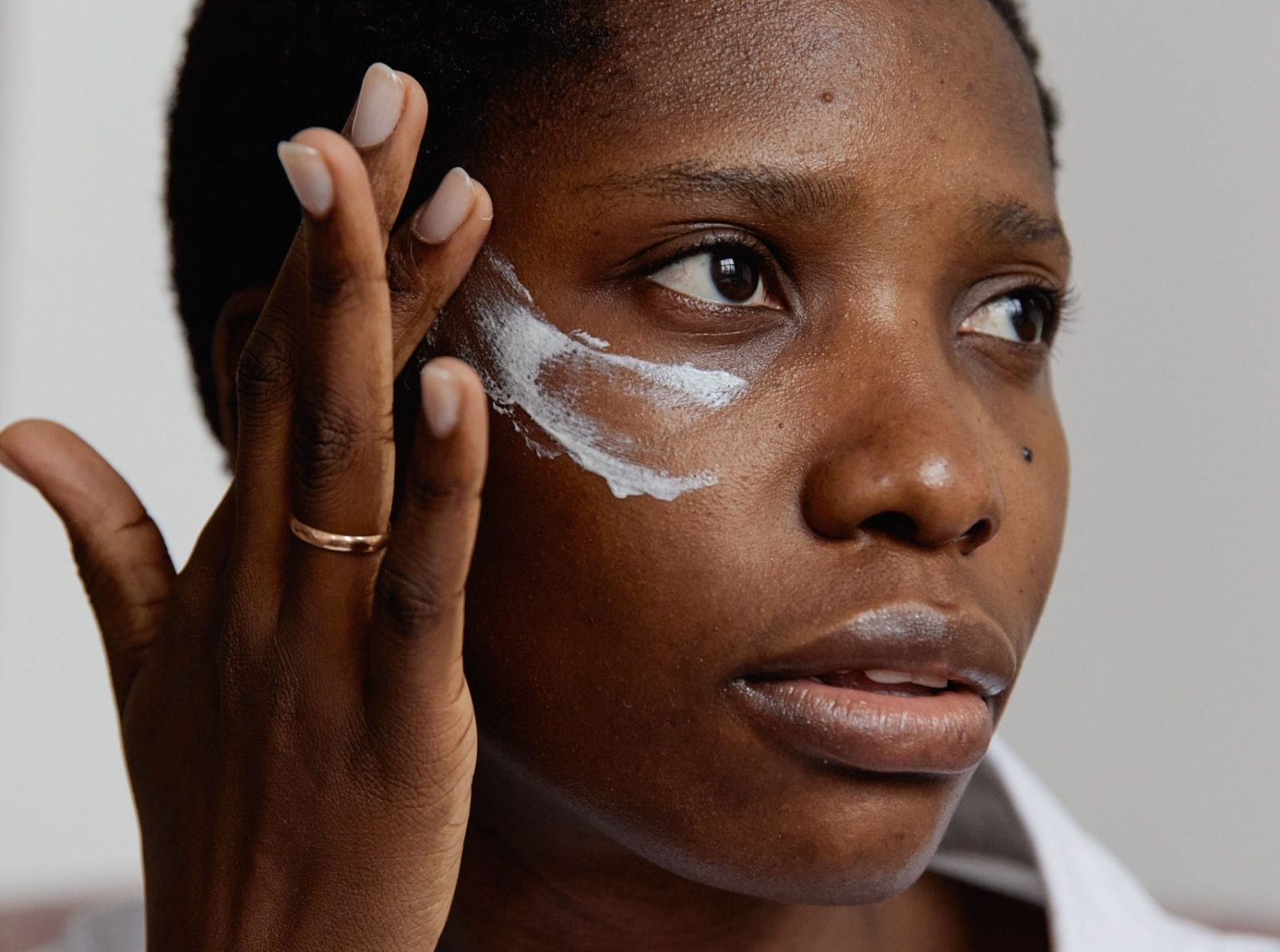 Patient receiving a collagen-boosting aesthetic skin treatment.