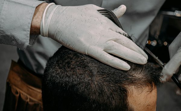 A woman experiencing hair shedding while using weight-loss medication.