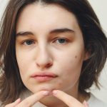Woman with visible acne applying skincare product to her face