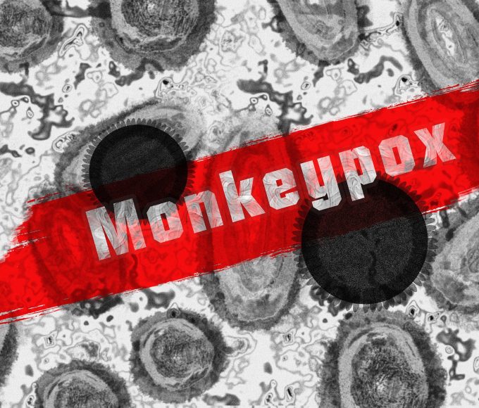 Mpox skin lesions as South Africa records an increase in confirmed cases